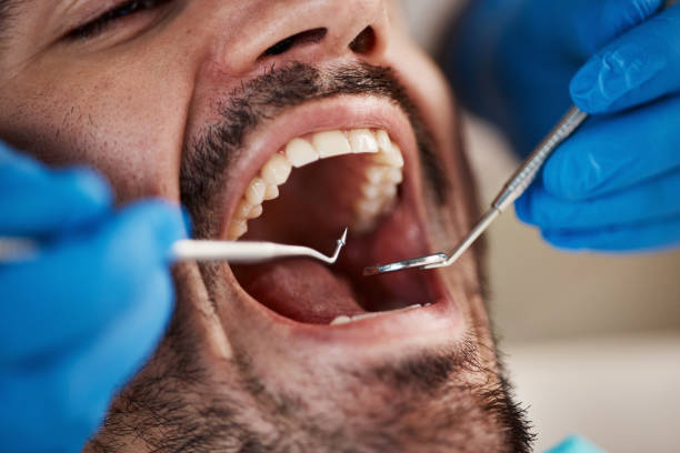Best Emergency Gum Treatment in Silver Springs, NV