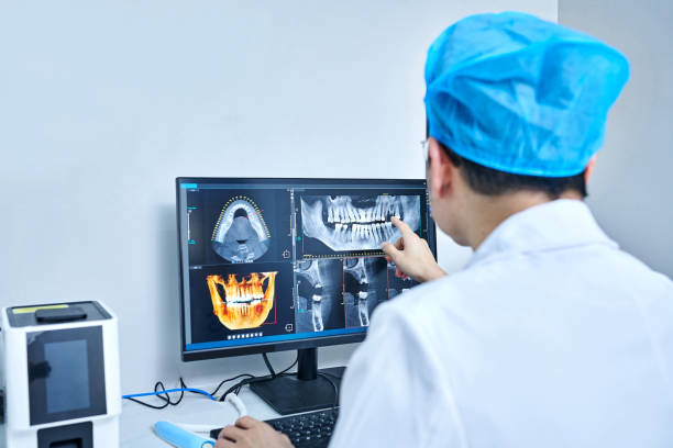 Best Emergency Tooth Extraction in Silver Springs, NV